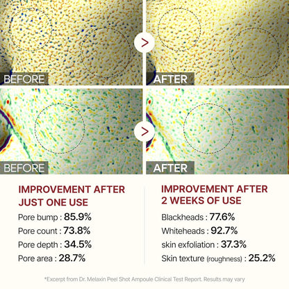 Glow Radiance Rice Ampoule